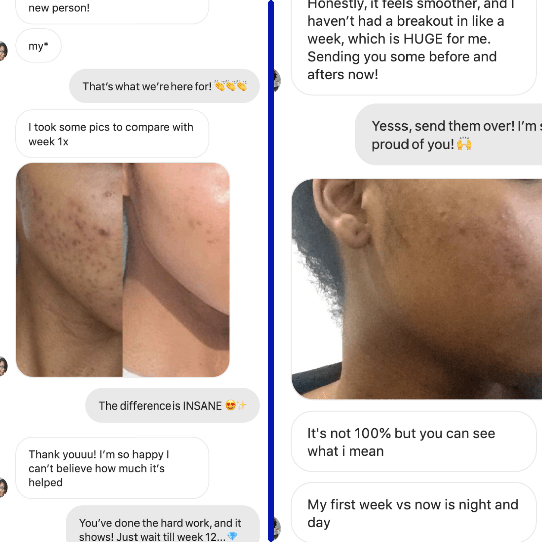 Clear Skin Food™ 3 - months by Amaka – supplement