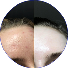 Day 37