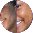Day 90