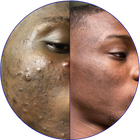 Day 89