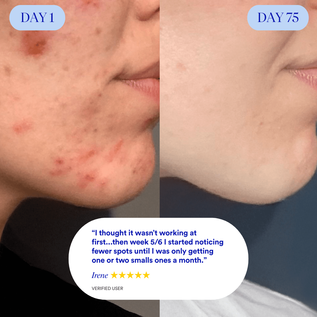 Clear 90™ (3 - Months) by Amaka – supplement