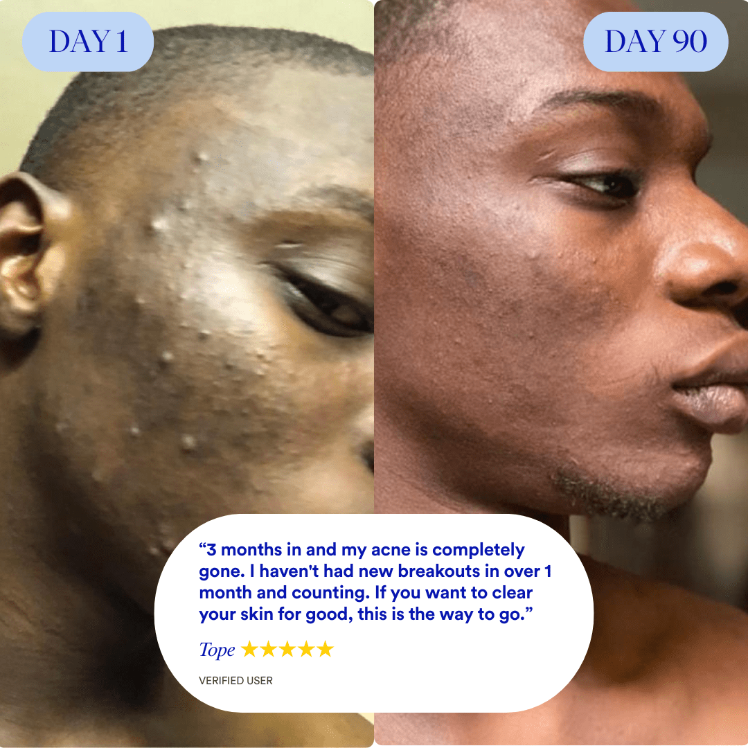 Clear 90™ (3 - Months) by Amaka – supplement