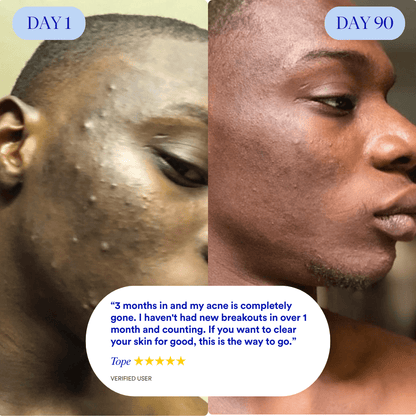 Clear 90™ (3 - Months) by Amaka – supplement