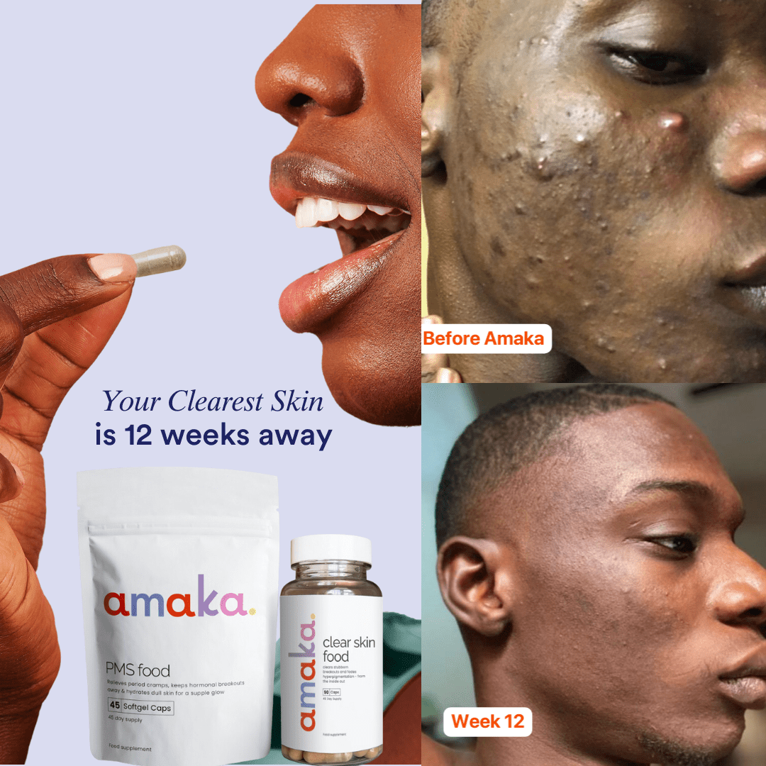 Clear 90™ (3 - Months) by Amaka – supplement