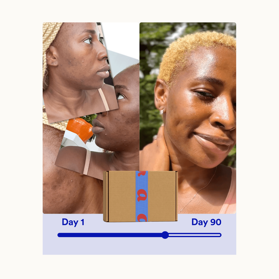 Clear 90™ (3 - Months) by Amaka – supplement