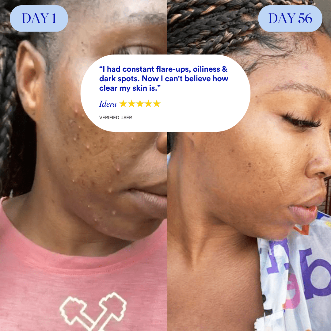 Clear Skin Food™ 3 - months by Amaka – supplement