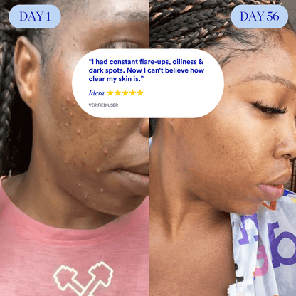 Clear Skin Food™ 3 - months by Amaka – supplement