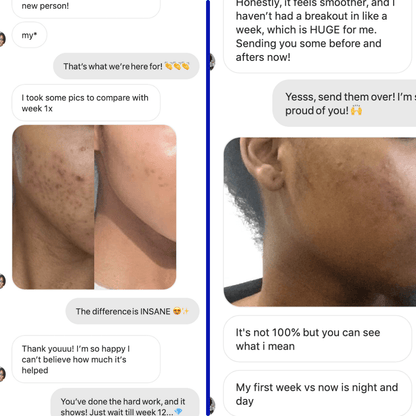 Clear Skin Food™ 3 - months by Amaka – supplement